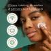 Rael Miracle Clear Barrier Cream with Succinic Acid & Vitamin B - Daily Moisturizer for Oily Skin - Paraben-Free & Vegan - 1.8 oz - Buy Online on GoSupps.com