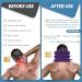 Jaximy Purple Neck Stretcher & Cervical Traction Device for Neck Pain Relief - Adjustable Inflatable Neck Brace & Cervical Pillow for Home Use - Buy Online on GoSupps.com