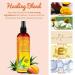 After Sun Solar Recovery Spray with Freshly Cut Texas Aloe - Instant Sunburn Relief for Skin & Face, Mango & Chamomile - 12 Oz - Buy Online on GoSupps.com