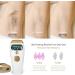 IPL Hair Removal Laser by UK Company - Permanent Hair Remover for Sensitive Skin - Buy Online on GoSupps.com