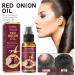 Onion Hair Thickening Spray - 30ml Onion Oil Hair Anti Loss Spray | Red Onion Hair Oil For Hair Regrowth Strengthening Hair Roots And Follicles | Pure Onion Oil Spray For Hair Thickening - Buy Online on GoSupps.com