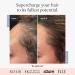 Better Not Younger Superpower Advanced Duo - Hair Densifying Scalp Serum & Massaging Applicator for Stronger, Thicker-Looking Hair - 2 fl.oz - Buy Online on GoSupps.com