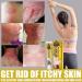 KnjoFly Revitaskin Chinese Herbal Eczema Psoriasis Relief Cream for Adults - Set of 3 - Buy Online on GoSupps.com