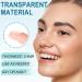 L otFancy Acne Patches 240 Count - Hydrocolloid Pimple Patches for Face - 3 Sizes for Blemishes & Spots - Skin Acne Dots Treatment - Buy Online on GoSupps.com