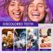 Purple Teeth Whitening Toothpaste | V34 Color Corrector for White Teeth & Gum Repair | Stain Removal for Yellow Teeth - Buy Online on GoSupps.com