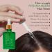 Vegan Hair Serum for Women & Men - Boost Growth & Prevent Hair Loss - Rosemary & Amla Hair Vitamins - 1 Fl Oz - Buy Online on GoSupps.com