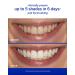 Supersmile Original Mint Teeth Whitening Travel Kit - Brighten Your Smile Anywhere | Buy Now - Buy Online on GoSupps.com