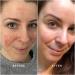 True Botanicals CLEAR Repair Nightly Treatment Serum | Non-Toxic Cruelty-Free Anti-Aging Serum | Hyaluronic Acid for Blemishes & Wrinkles | MADE Safe - 1 fl oz | International Shipping Available - Buy Online on GoSupps.com