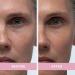 Doll 10 Smooth Assist Skin Energy Souffl - Hydrating Daily Cream for Pore Size Skin Tone & Texture - Vegan & Cruelty Free (50 ml) - Shop Internationally - Buy Online on GoSupps.com