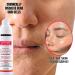 gymsegb 20% Glycolic + 10% Lactic Acid AHA Chemical Peel Professional Facial Exfoliant with 3% Hyaluronic Acid for Texture Dark Spots & Pores Fragrance Free Sensitive Skin & Melanin Safe - 30ml 1 Fl Oz (Pack of 1) - Buy Online on GoSupps.com