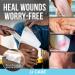JJ CARE Gauze Rolls Pack of 24 - Individually Wrapped Bandage Roll (4 x 4.1 Yards) + Bonus Medical Tape - Latex Free & Stretchable - Buy Online on GoSupps.com