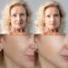 Navabelle Premium Face Wrinkle Patches - Forehead & Anti Wrinkle Tape for Fine Lines (192 PCs) - Buy Online on GoSupps.com