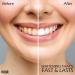 MasterMedi Non-Sensitive Teeth Whitening Strips - Fast-Result Stain Removal Kit - 56 Strips/28 Treatments - Buy Online on GoSupps.com