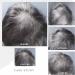 BWOW Biotin & Caffeine Hair Regrowth Shampoo Pro Vitamin B5 Vitamin E Hair Loss Treatment Panthenol Hair Regrowth Shampoo - Stimulate Hair Growth Reduce Hair Loss - Hair Solution - Buy Online on GoSupps.com