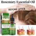 GIMOCOOL Rosemary Essential Oil 30ML Rosemary Hair Oil for Hair Growth Organic Hair Serum to Nourish Scalp and Stimulate Hair Growth - Buy Online on GoSupps.com