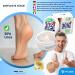 Mr. Foot 30hs Shoot Ointment - 30% Urea Foot Repair Cream for Corn Removal & Dry Skin with Propolis & Evening Primrose Oil - 200ml (1 Pack) - Buy Online on GoSupps.com