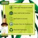 Anti Acne Face Serum | Glycolic & 2% Salicylic Acid - 30ml for Clear Skin - International Shipping Available - Buy Online on GoSupps.com