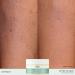 REN Clean Skincare Evercalm Barrier Support Body Balm - Nourishing Balm for Sensitive Dry & Eczema-Prone Skin - 3.04 fl oz - International Shipping - Buy Online on GoSupps.com