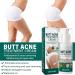 Cr me nettoyante contre l'acn pour les fesses et les cuisses 100 ml de cr me d'acn pour les fesses cr me nettoyante anti-acn cr me anti-boutons sur les fesses limine les boutons et les taches - Buy Online on GoSupps.com