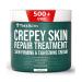 TreeActiv Crepey Skin Repair Treatment with Retinol for Face & Body | Anti-Wrinkle Serum - Buy Online on GoSupps.com