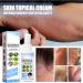 Natural Psoriasis Relief Spray for Itchy and Red Skin - Clinical Strength Ointment with Herbal Ingredients - 1oz (2 Pcs) - Buy Online on GoSupps.com