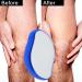WFRAU Men & Women Painless Crystal Hair Eraser & Skin Exfoliator Tool - Magic Crystal Hair Removal for Arms Legs Back for Body Any Part (blue new) - Buy Online on GoSupps.com
