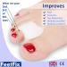 FeetFix Bunion Corrector Toe Separators Minimally Invasive Gel Hallux Valgus Big Toe Straightener Protector Splint Immediate Foot Pain Relief 4 Pack Wear With Shoes Spacer Medical Grade - Buy Online on GoSupps.com