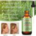 Organic Rosemary Oil for Hair Growth & Scalp Strengthening - 2 Fl Oz (60 ml) - Nourishing Hair Care Treatment - Aromatherapy for Skin & Face - Buy Online on GoSupps.com