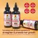 Tropic Isle Living Strong Roots Red Pimento Hair Growth Oil 4oz | Moisture & Shine Stimulates Hair Growth Strengthens Hair - Brush Set Included - Buy Online on GoSupps.com