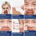 50 Piece Nose Paving Snoring Solution | Better Breathing Snor Popper | Anti-Snoring Nasal Spreaders for Sleep & Sports - Buy Online on GoSupps.com