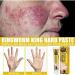 Zemibor Revitaskin Eczema Treatment Cream - Psoriasis Relief for Adults (3pcs) - Buy Online on GoSupps.com