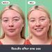 HERO COSMETICS Blemish Recovery Cream - Dermatologist-Tested Suitable for Sensitive Skin - 15 ml - Buy Online on GoSupps.com
