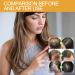 Hair Thickening Serum Spray with Biotin - Set of 5 for Stronger Healthier Hair Growth | Enhance Length & Volume - Buy Internationally - Buy Online on GoSupps.com