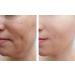 Vitality Precision Skin Retinol Pads 0.5% - 3 Month Supply for Youthful Skin | International Shipping Available - Buy Online on GoSupps.com