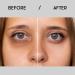Sane Eye Cream for Dark Circles & Puffiness - Caffeine & Niacinamide Hydrating Treatment - 0.34 fl oz International Shipping - Buy Online on GoSupps.com