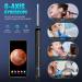 Earnza 1080P Ear Cleaner Camera Kit - Otoscope with Light, 8 Pcs Ear Pick Set for Adults - iPhone, iPad, Android Compatible - Black - Buy Online on GoSupps.com