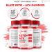 Blast Keto ACV Gummies Official Blast ACV Gummies Blast ACV Keto Advanced 1000MG Vitamin Gummys All Natural ACV Formula for Energy and Fitness Support Apple Cider Pomegranate Beet Root (60 Gummies) - Buy Online on GoSupps.com