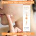 Dermatologist Formula Dark Spot Corrector Serum with 17% Vitamin C, Licorice Extract, Safflower Seed Oil, and Aloe - Face Brightening Treatment - Buy Online on GoSupps.com
