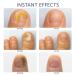 Nail Fungus Treatment - Extra Strength Solution for Toenail & Fingernail Restoration - Buy Online on GoSupps.com