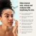 Azelaic Acid 14% Cream for Acne & Rosacea Relief - Reduce Inflammation & Minimize Pores - 1 Fl Oz - Buy Online on GoSupps.com