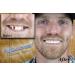 Instant Smile Professional Cosmetic Upper: Hand Crafted Detail, Custom Fit at Home for Medium to Large Mouths - Buy Online on GoSupps.com