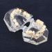 Orthodontic Model PVC Resin for Malocclusion Treatment - Adult & Child Dental Education Model with Wire Chain - Buy Online on GoSupps.com
