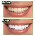 ONTEL Miracle Teeth Whitener | Natural Coconut Charcoal Powder for Gentle Teeth Whitening - Removes Stains from Coffee, Smoking, and More! (As Seen on TV) - Buy Online on GoSupps.com