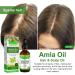 Amla Oil - Amla Hair Oil - Indian Amla Oil for Hair & Skincare - 100% Natural - Amla Oil for Natural Beautiful Long Soft & Strong Hair - Indian Hair Oil for Skin and Face (1) - Buy Online on GoSupps.com