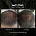 Naturale Shampoo for Thinning Hair - All-Natural Physician-Formulated Blend with Saw Palmetto & Essential Nutrients - 200 ML - Buy Online on GoSupps.com