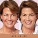 Laura Geller Better Than Bare Tinted Moisturizer SPF 50+ Medium 230 - Buy Online on GoSupps.com