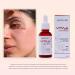 SKINLAB - Vita-A Serum - Retinol - Buy Online on GoSupps.com