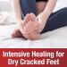 Kerasal Intensive Foot Repair 1oz - Pack of 4 | Foot Care Treatment - Buy Online on GoSupps.com
