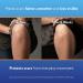 ScarAway Complete Scar Treatment Kit - 2 Tan Silicone Scar Sheets and Scar Gel, Water-Resistant and Self-Adhesive - Buy Online on GoSupps.com