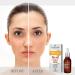 FLOSLEK Whitening Brightening Face Acid Night Peeling | 30 ml | Lightens Moisturizes Softens & Evens Skin Colour | Smoother & Brighter Complexion | Reduces the Intensity of Blemishes - Buy Online on GoSupps.com